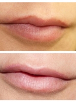 corrective-color-lips.jpg