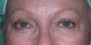 Brows- Corrective Tattooing 1 before
