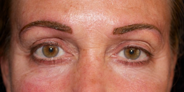 Brows- Corrective Tattooing 5 after