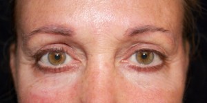 Brows- Corrective Tattooing 5 before