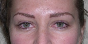 brows and lash enhancement- virgin skin 15 after