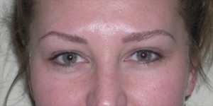 brows and lash enhancement- virgin skin 15 before