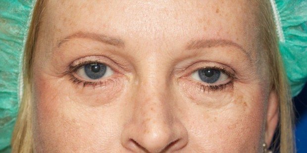 brows- corrective tattooing 4 healed