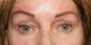 brows- pre chemotherapy 3 after