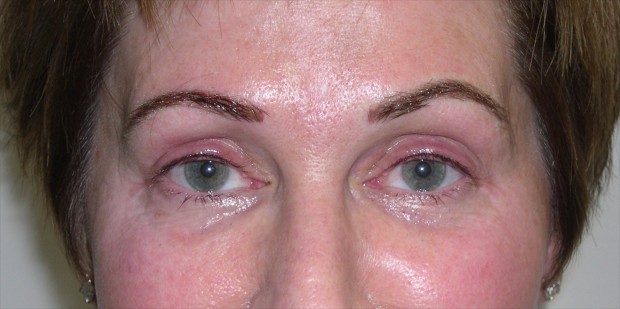 permanent makeup for brows and upper lash enhancement after