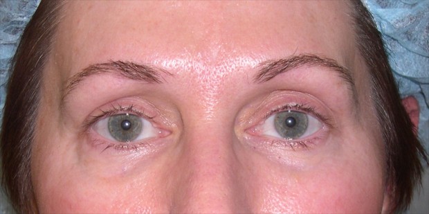 permanent makeup for brows and upper lash enhancement before