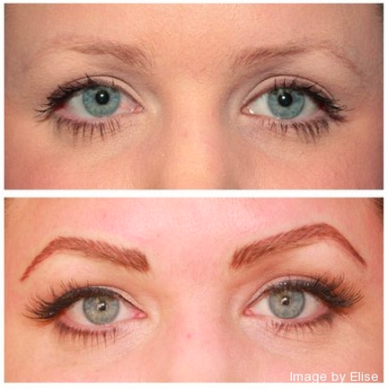 image by elise eyebrows permanent makeup affordable scar removal in newport beach
