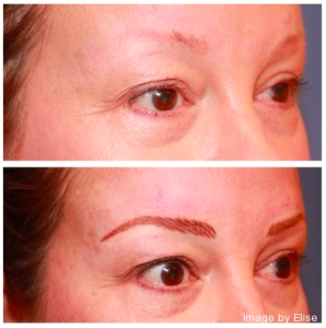 Realistic Eyebrows for Chemotherapy Patients in Newport Beach