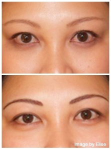 Realistic Eyebrows for Chemotherapy Patients in Newport Beach